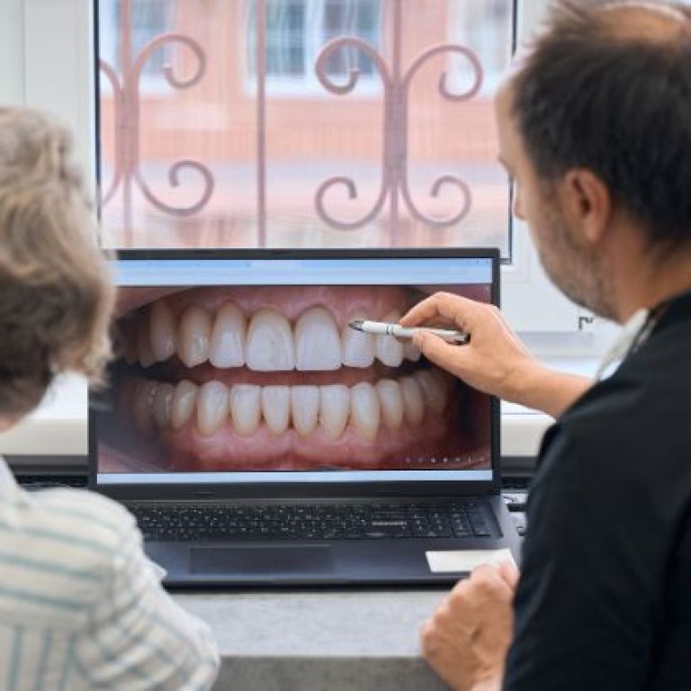 Digital Smile Design